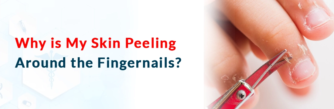  Why is My Skin Peeling Around the Fingernails?